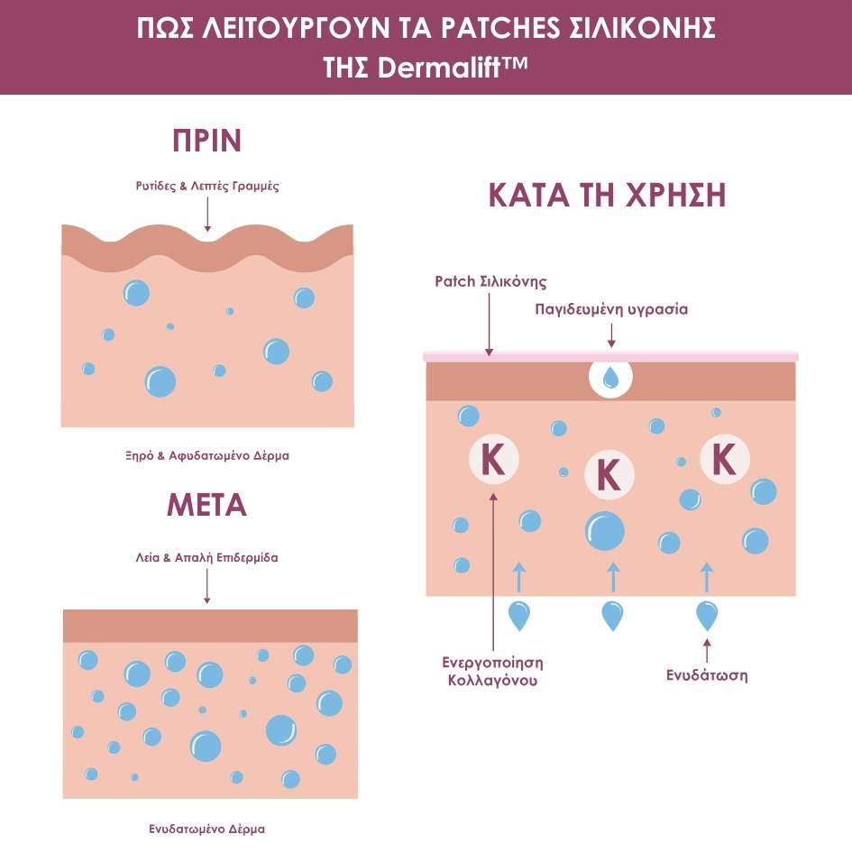 Dermalift για Μάτια & Στόμα